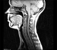 Изображение сагиттального среза головы и шеи человека, получено методом МР-томографии